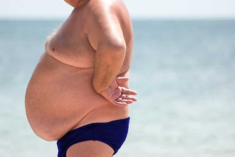 Experts warn of obesity "pandemic" in Spain
