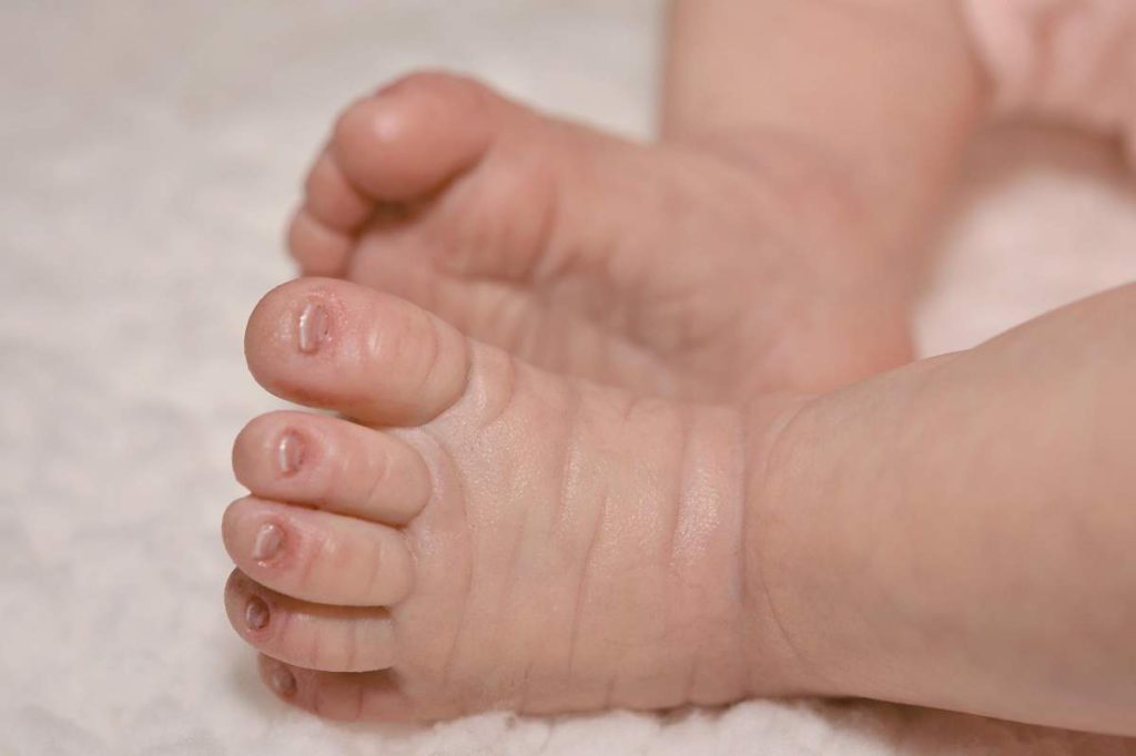 Parents Accidentally Kill Their Baby While Sleeping In Murcia