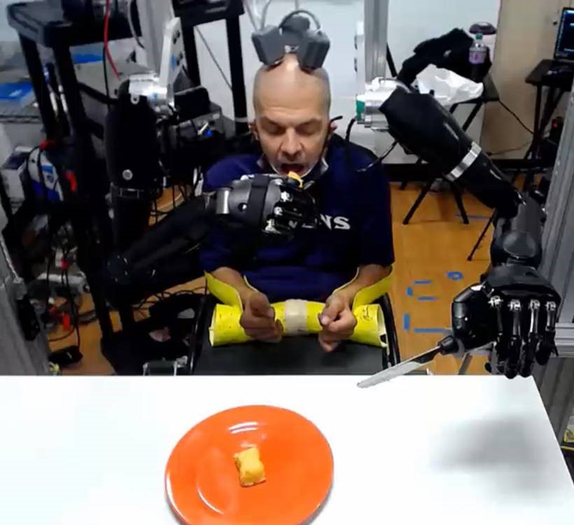 Quadriplegic patient uses brain signals to feed himself with two advanced prosthetic arms