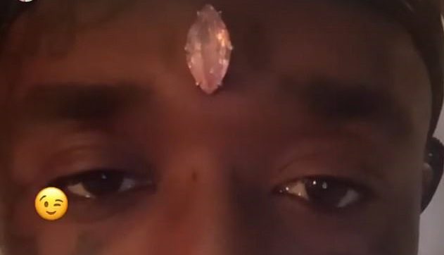 US rapper gets pink diamond piercing in forehead