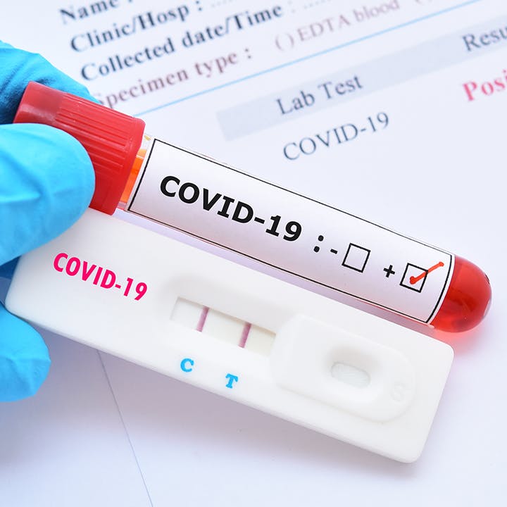 Germany Approves The Sale Of Covid Tests In Supermarkets