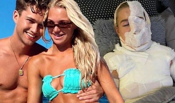 Strictly star Aj Pritchard's Girlfriend Suffers Third-Degree Burns After Online Stunt Goes Badly Wrong