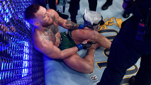 Conor McGregor snaps ankle in first round to lose Dustin Poirier trilogy