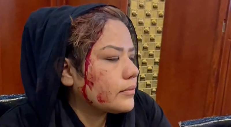 Peaceful Women's rights protest turns violent in Afghanistan