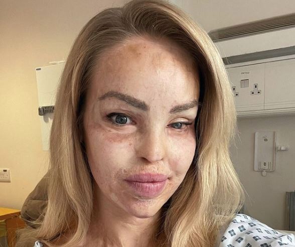 Katie Piper rushed to hospital for emergency operation