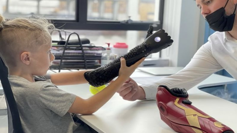 British schoolboy with one hand raising money to buy high-tech bionic arm