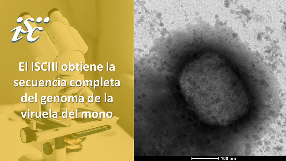 Spanish researchers obtain first 100% genome sequence draft of ...