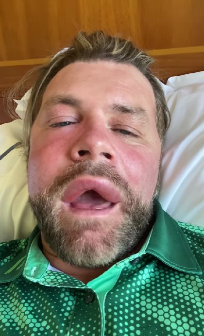 Fans in horror as 42-year-old pop star has an allergic reaction