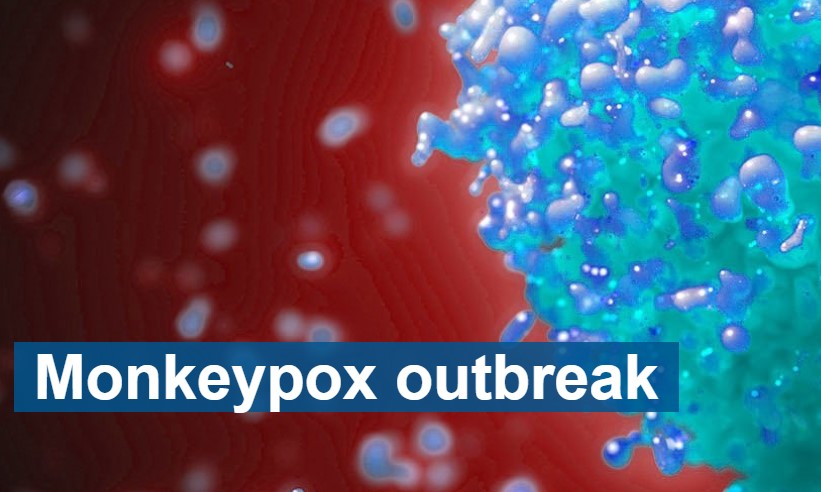 Monkeypox cases in UK SKYROCKET as vaccines begin to run out.