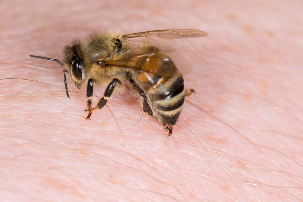 Serious allergic reactions to wasp and bee stings increasing