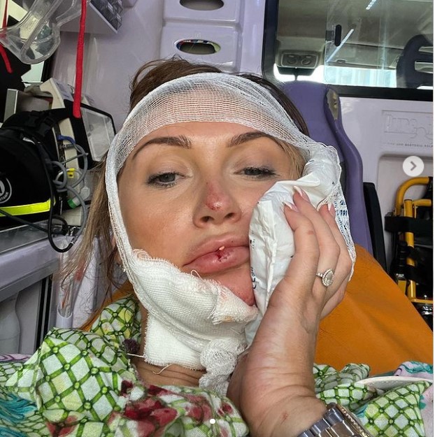Fans send their support to UK TV celebrity after road accident on holiday