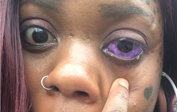 Woman loses her sight after having her eyeballs tattooed