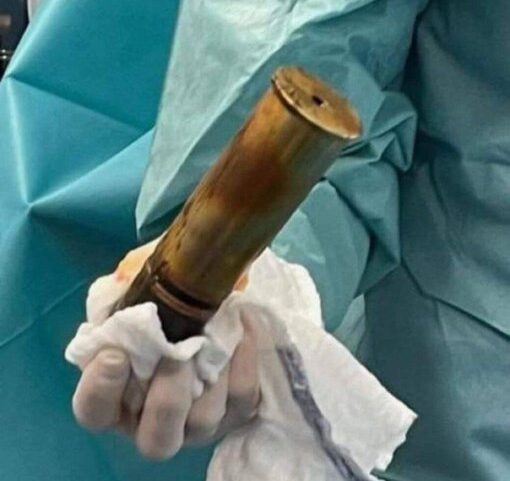 ‘Bum scare’ as a man with a WWI bomb up his rectum sparks hospital evacuation