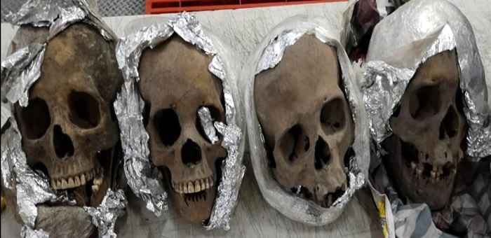 Four human skulls detected in a package by airport X-ray security scanner