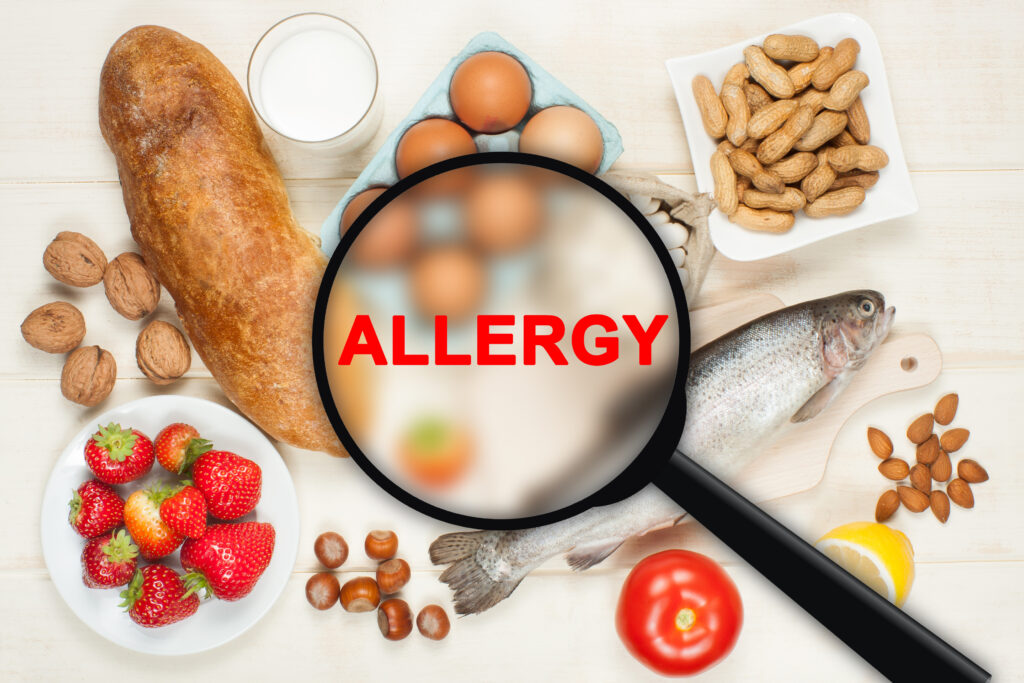 Patient education: Avoiding food allergy triggers