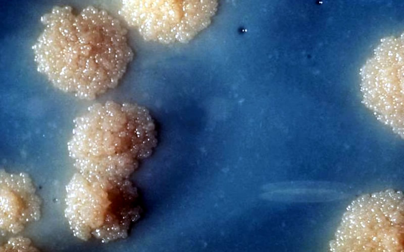 Image of a tuberculosis culture.