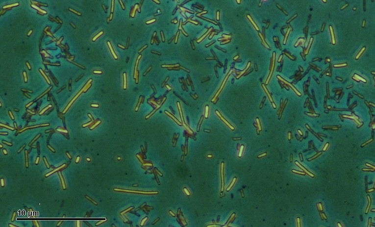 Image of legionella bacteria.