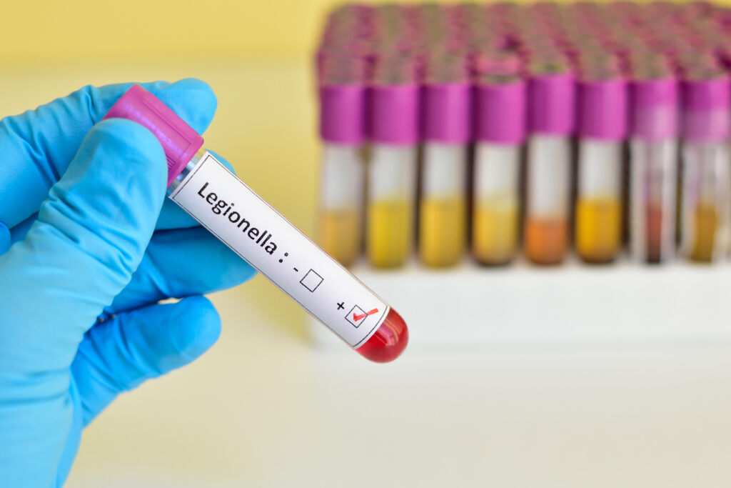 Image of medical test tube labelled 'legionella'.