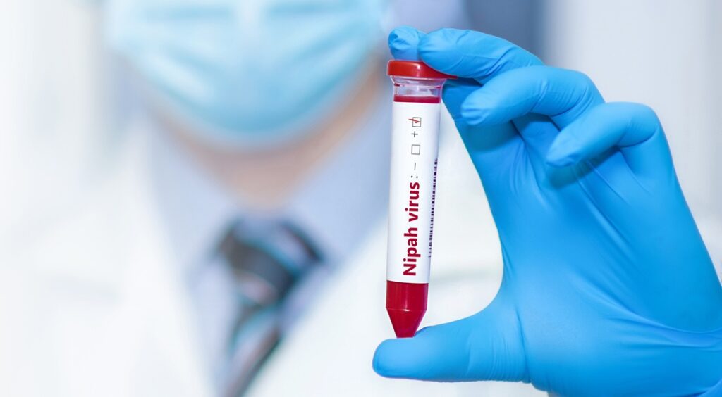 Nipah Virus: New Outbreak Revives Pandemic Fears! What Happens Now?!