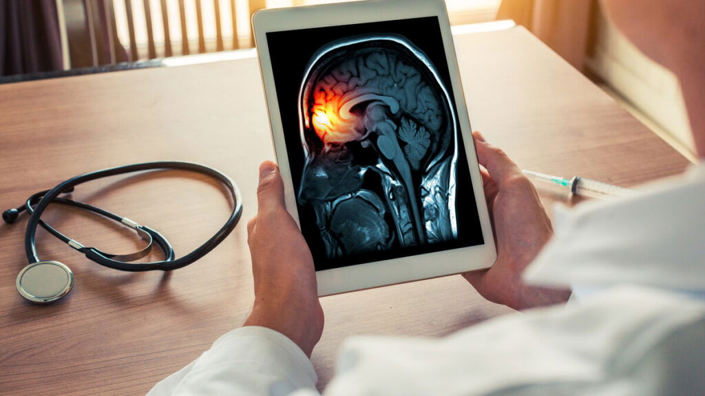 Healthcare monitoring meningitis cases in England as outbreak investigation continues