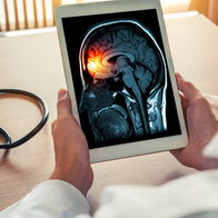 Healthcare monitoring meningitis cases in England as outbreak investigation continues