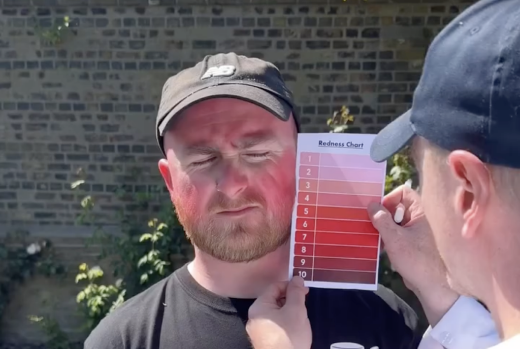 Spanish TV hosts left stunned by ‘most sunburnt men in Ireland’ comedy sketch after mistaking it for real news