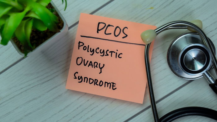 Sticky note reading “PCOS Polycystic Ovary Syndrome” next to a stethoscope during discussion about the condition’s official name change.