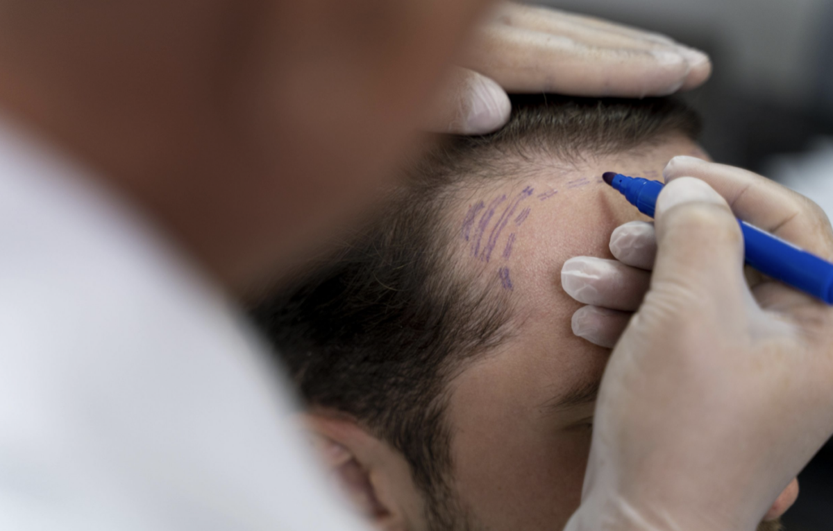 Scalp diagnostics