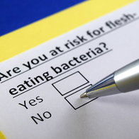 Illustration about the risk of infection from flesh eating bacteria linked to warm coastal waters.