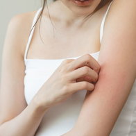 A close-up of a person scratching an itchy, red rash on their upper arm, illustrating common physical symptoms of a scabies infestation or skin irritation.