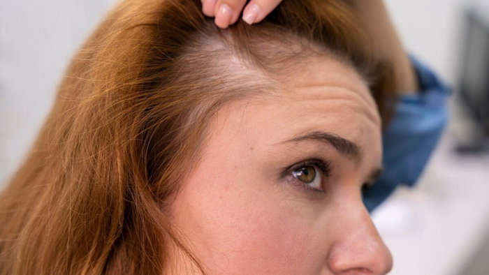 hair mesotherapy.