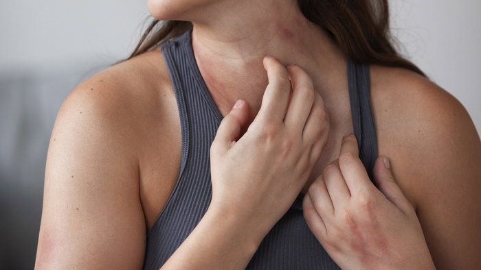 Woman suffering from rash on neck and itching