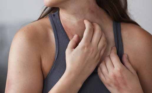 Woman suffering from rash on neck and itching
