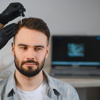 Male patient receiving scalp treatment for hair loss at a trichology clinic, using specialized medical equipment