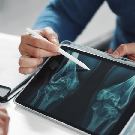Taking osteoporosis medication in Spain? New safety update flags unusual fractures