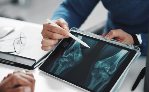 Taking osteoporosis medication in Spain? New safety update flags unusual fractures