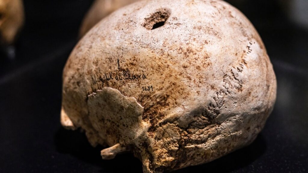 Trepanation to Aspirin: How Ancient Medical Interventions Shaped Modern Neuro-Care